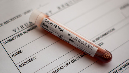 Blood contaminated with virus inside a test tube. Test tube on a medical form. 