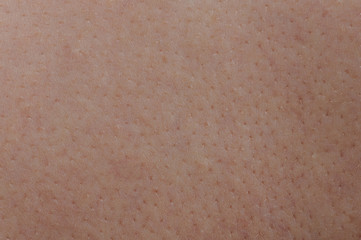 Dry human skin texture