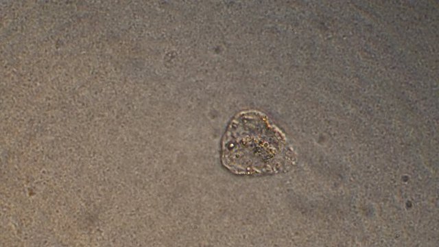 Microscopy of protozoa in the water sample. Magnification 300x microorganism under microscope in active movement.