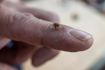 Kleiner Krebs auf einem Finger