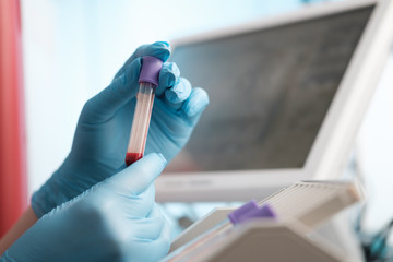 Scientist studying coronavirus in laboratory