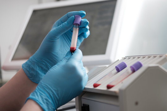 Scientist studying antidote characteristics in laboratory