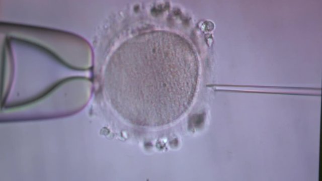 Filming of process of fertilization of female egg, sperm penetrates, genetics, IVF, gynecology, conception of new life, laboratory manipulations, under microscope, precise movement, human population