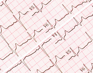 Cardiogram pictures. A few research result by CU