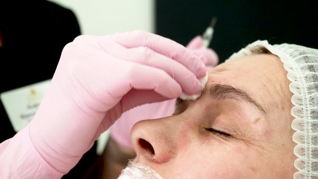 Beauty clinic. Beautician hands in gloves making face aging injection in a female skin. A woman gets beauty facial cosmetology procedure. Botox. collagen injections. Shot in 4k