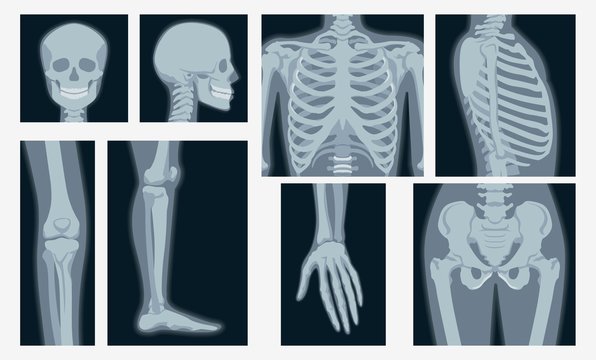 Different x-rays shot of human body part set vector flat illustration. Cartoon various x-ray pictures of head, hands, legs, torso of skeleton character isolated on white background