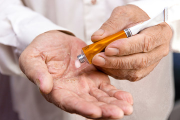 Ointment on the hands of an elderly person. Applying the ointment and emollient cream in the treatment and hydration of the skin . Problem skin in old age