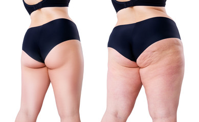 Overweight woman with fat legs and buttocks, before after weight loss concept isolated on white...