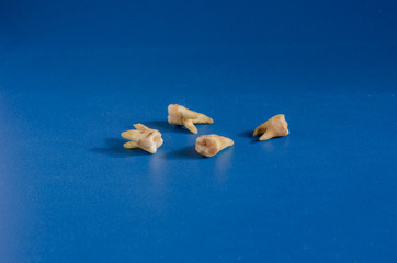 Four torn human teeth on a blue background. A close-up of spoiled molars. Eye level shooting. Selective focus.