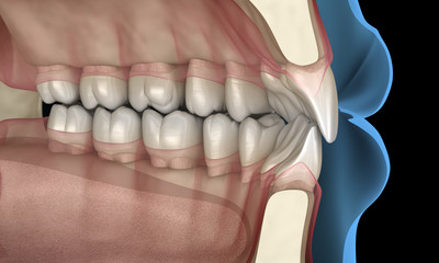 Healthy human teeth with normal occlusion, 3D Illustration - obrazy, fototapety, plakaty