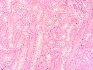 picture of histology human tissue with microscope from laboratory (not Illustration Designation)