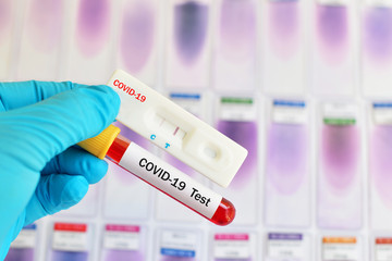 Cassette rapid test for COVID-19 or novel coronavirus 2019 found in Wuhan, China