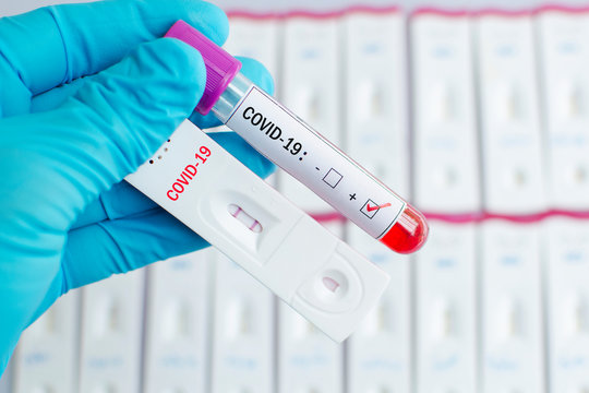 Cassette rapid test for COVID-19 or novel coronavirus 2019 found in Wuhan, China