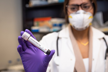 Doctor showing Coronavirus positive blood sample