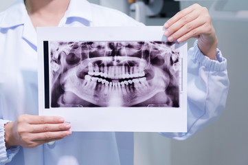 Close up woman dentist holding patient mouth digital film.Female doctor showing patient oral scan.The dentist explained about the oral cavity to the patient at the dental office in the hospital.