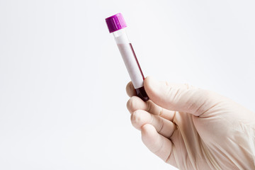 Hand holding blood in test tube close up. White label.