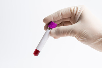 Hand of a doctor holding red blood in test tube on white background, close up, White label.