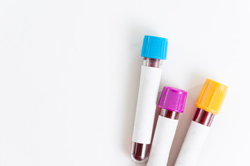 Blood sample in vacuum tube isolated on white background. Top view.