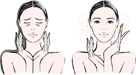 女性　クマ　ビフォーアフター