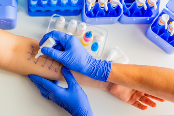 Allergy skin prick tests.Allergy skin prick tests. Allergy diagnostics.