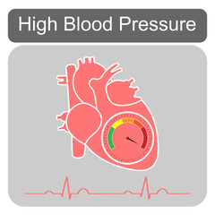 Human cardiac anatomy with speedometer show hypertensive crisis stage and heart beat isolated on grey background.Design for logo.Concept for medical health care.High blood pressure.Vector.