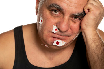 unhappy middle aged man with blood on his face