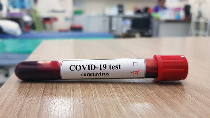 Positive COVID-19 test and laboratory sample of blood testing for diagnosis new Corona virus...
