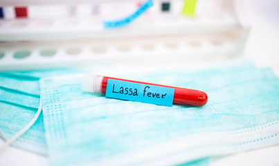 test Lassa fever in vitro in a laboratory.