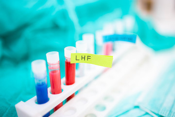test Lassa fever in vitro in a laboratory.