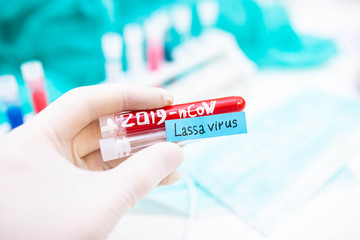 2020 epidemic test tubes with Lassa fever and coronavirus,
