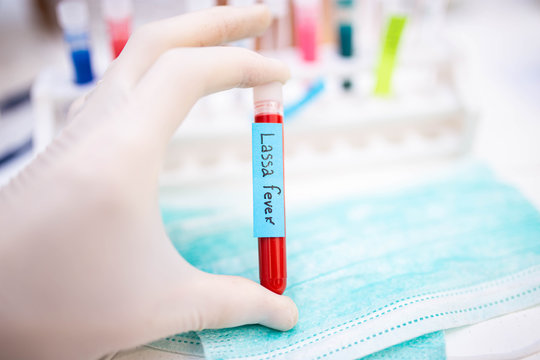 test Lassa fever in vitro in a laboratory.