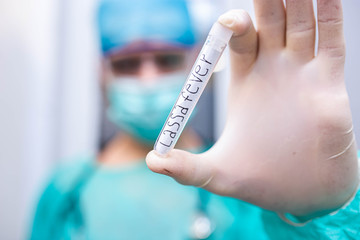 Scientist doctor holds test tube with Lassa fever