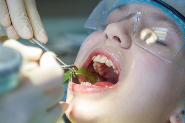 A child at the dentist's appointment. Dental treatment and brushing in the doctor’s office.