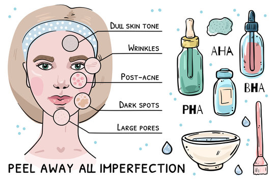 Illustration of skin problems that acid peeling solves.