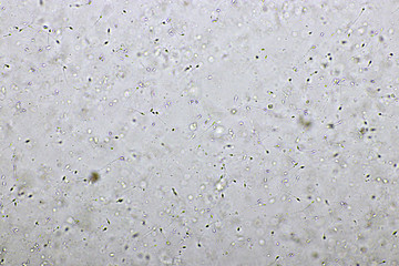 Sperm cells or spermatozoa in semen, analyze by microscope, 400x