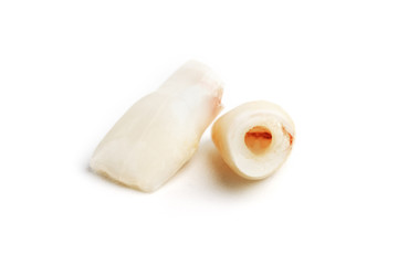 Baby teeth on a white background. Loss of two lower teeth of the child at the stage of formation of the jaw.