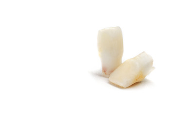 Baby teeth on a white background. Loss of two lower teeth of the child at the stage of formation of the jaw.