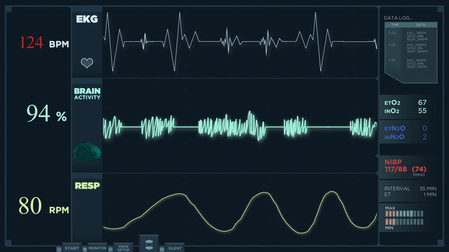 Animation of a fast electrocardiogram reading display.