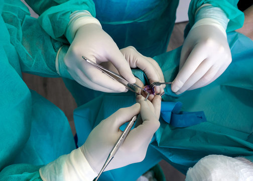 Professional male surgeon starting operation on thumb of feet in hospital