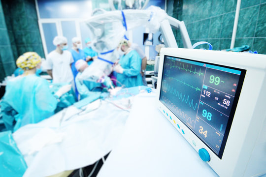 a group of surgeons operate on the patient's vital functions monitor close-up.