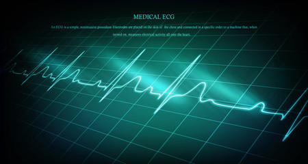 Heart with cardiogram - 2D illustration