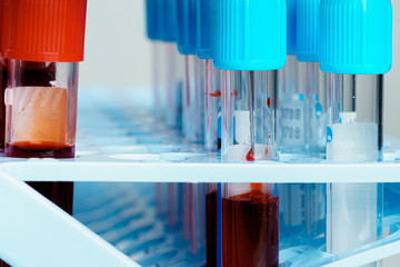 Blood sample tubes  medical equipment close up