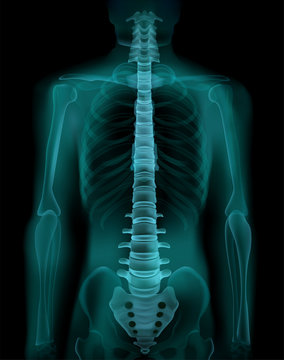 Spine X-Ray Realistic Image 