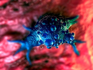 3d illustration - Bladder cancer cells - 324170451