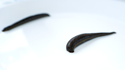 hirudotherapy, leeches as therapy, prevention of varicose veins