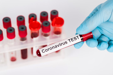 Obraz premium selective focus of scientist holding sample with coronavirus test lettering near test tubes isolated on white