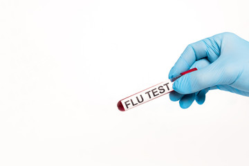 Obraz premium cropped view of scientist holding test tube with flu test lettering isolated on white