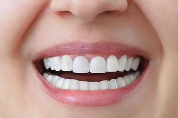 White teeth of a caucasian woman after treatment and whitening of teeth, dental crowns. Dentistry Close-up.