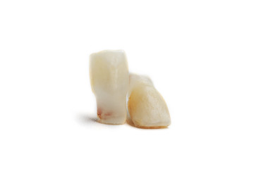 Baby teeth on a white background. Loss of two lower teeth of the child at the stage of formation of the jaw.