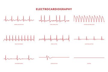 Electrocardiography Heartbeat Line monitor. vector EPS10 Illustration - obrazy, fototapety, plakaty
